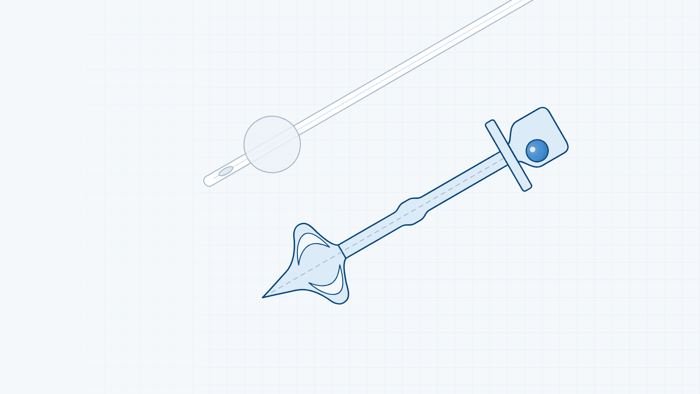 Schematic line illustration comparing a conventional catheter with a retention balloon, drawn in grey, and the balloon-free controlled catheter with its quatrefoil tip, sealing ring, baffle and ball-bead valve, drawn in blue